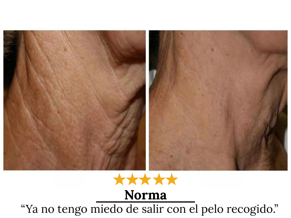 V LIFT NECK + V-MASK NECK™