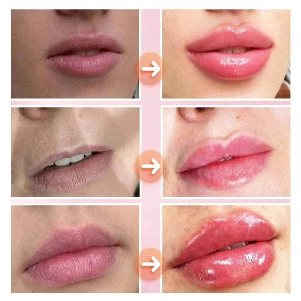LIP PLUMPER