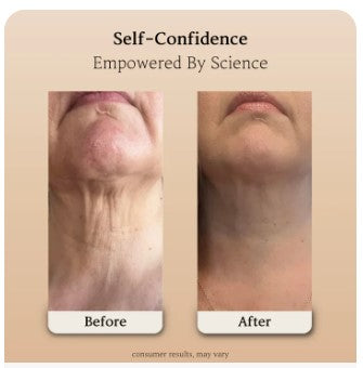 V LIFT NECK + V-MASK NECK™